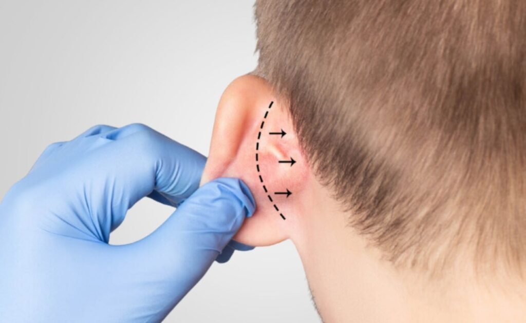 Ear Reshaping in Dubai: Local Expert Guide